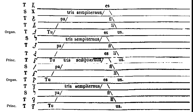 [Music]